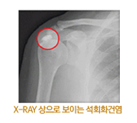 X-RAY  ̴ ȸȭǿ 