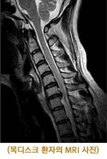 ũ ȯ MRI 